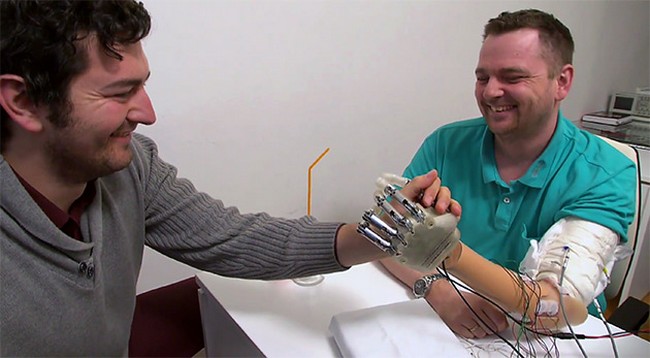 bionic-hand